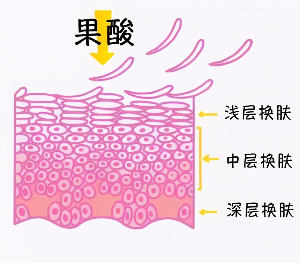 别人刷酸“换肤”你却烂脸？快来看看正确的使用方法
