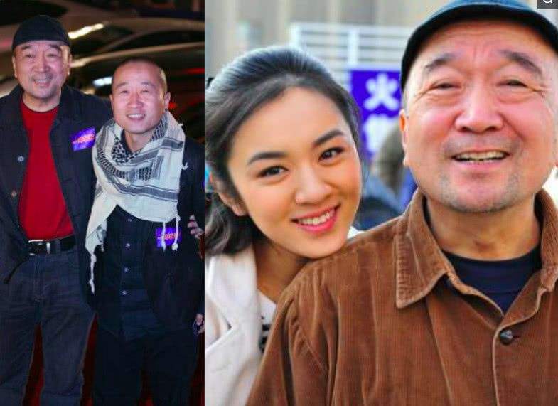 孩子身上这5个部位异常，警惕十大遗传病早期信号