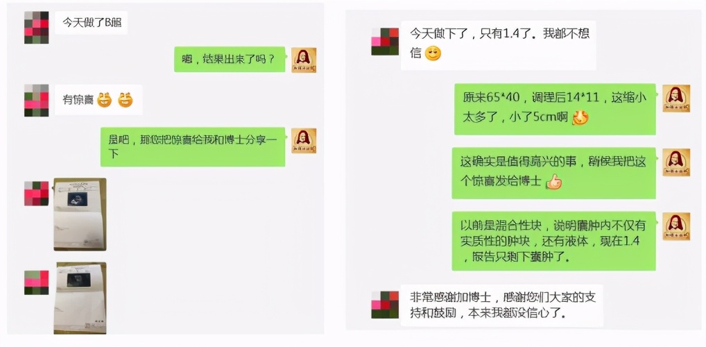 子宫切除后长6.5公分的囊肿，调理消掉5公分，这个方法很重要