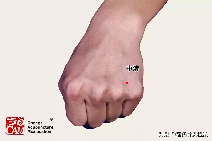答疑解惑 | 脑出血后遗症，左肢麻痛，按摩哪几个穴位能缓解痛苦