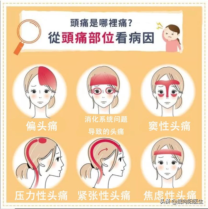 头痛的真相。头痛并不是大脑痛，颅周组织引起头痛