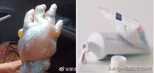 医学充电宝 ▏中国将成医美疗程消费第一大市场!越级手术、伪造医学文书等半年内深圳多家机构被查