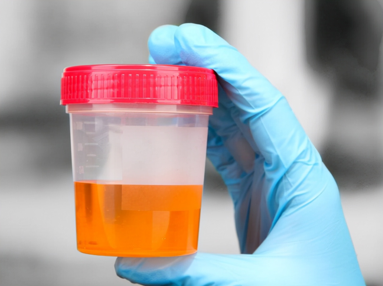 有人一喝水就尿多，有人却两个小时也不上厕所，哪种人身体更好？