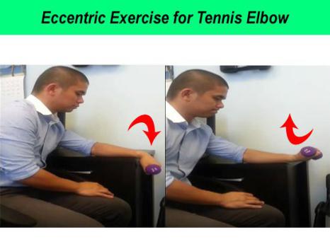 网球肘热敷一天几次一次多长时间(网球肘的治疗与康复（二）)