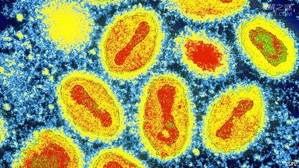 盘点：人类历史上造成大量死亡的6大传染病，有些至今还在肆虐