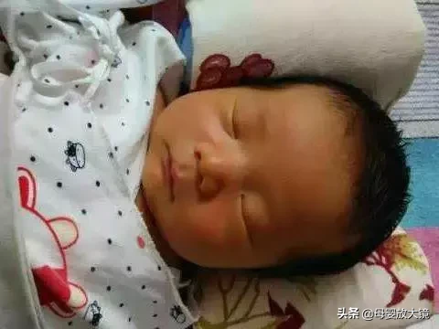 红斑、脱皮、痤疮…新生儿最易出现的10种皮肤问题，宝妈护理必备