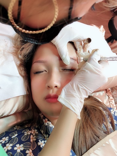 激光洗眉恢复过程图片(红眉) - 赤虎壹号