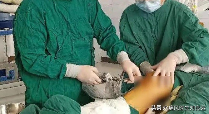 痛风患者都会长出痛风石吗？医生介绍痛风石治疗的四种方法