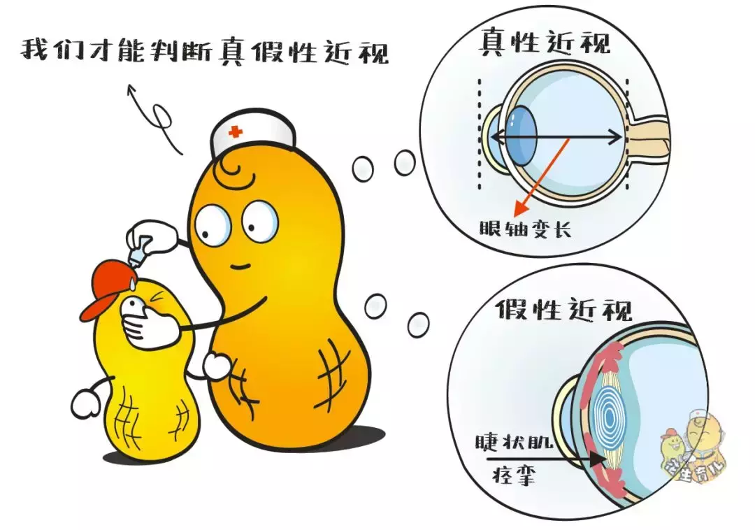 近视眼的确有双性子,有真性近视和假性近视之分.