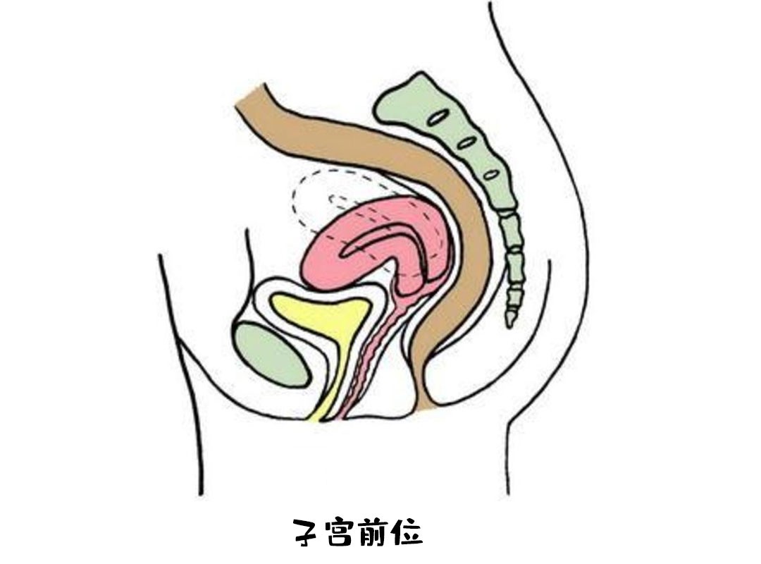 关于你所不知道的子宫后位与子宫前位