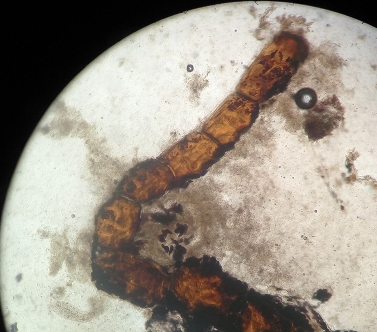 什么是狗狗绦虫?