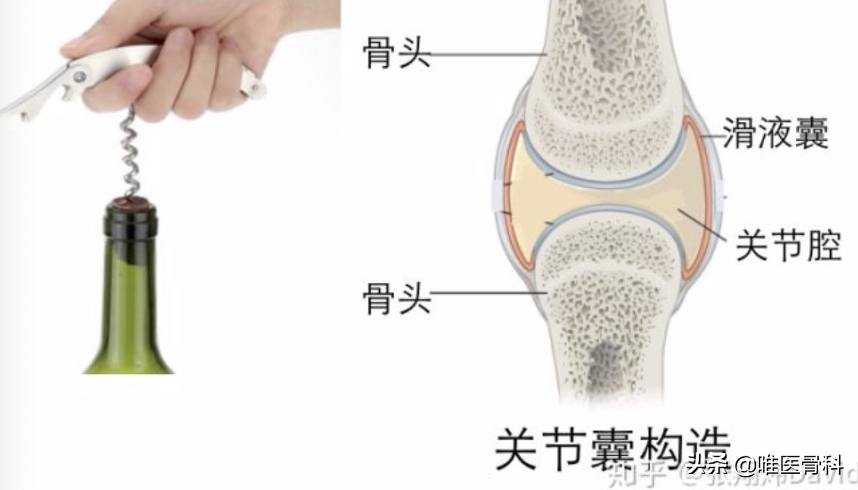 打篮球扭到膝盖里有响声(膝盖活动时“咔咔响”，这是病吗？主要看这 4 点)