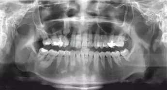 咸阳彩虹医院口腔科新进设备 提升诊疗质量