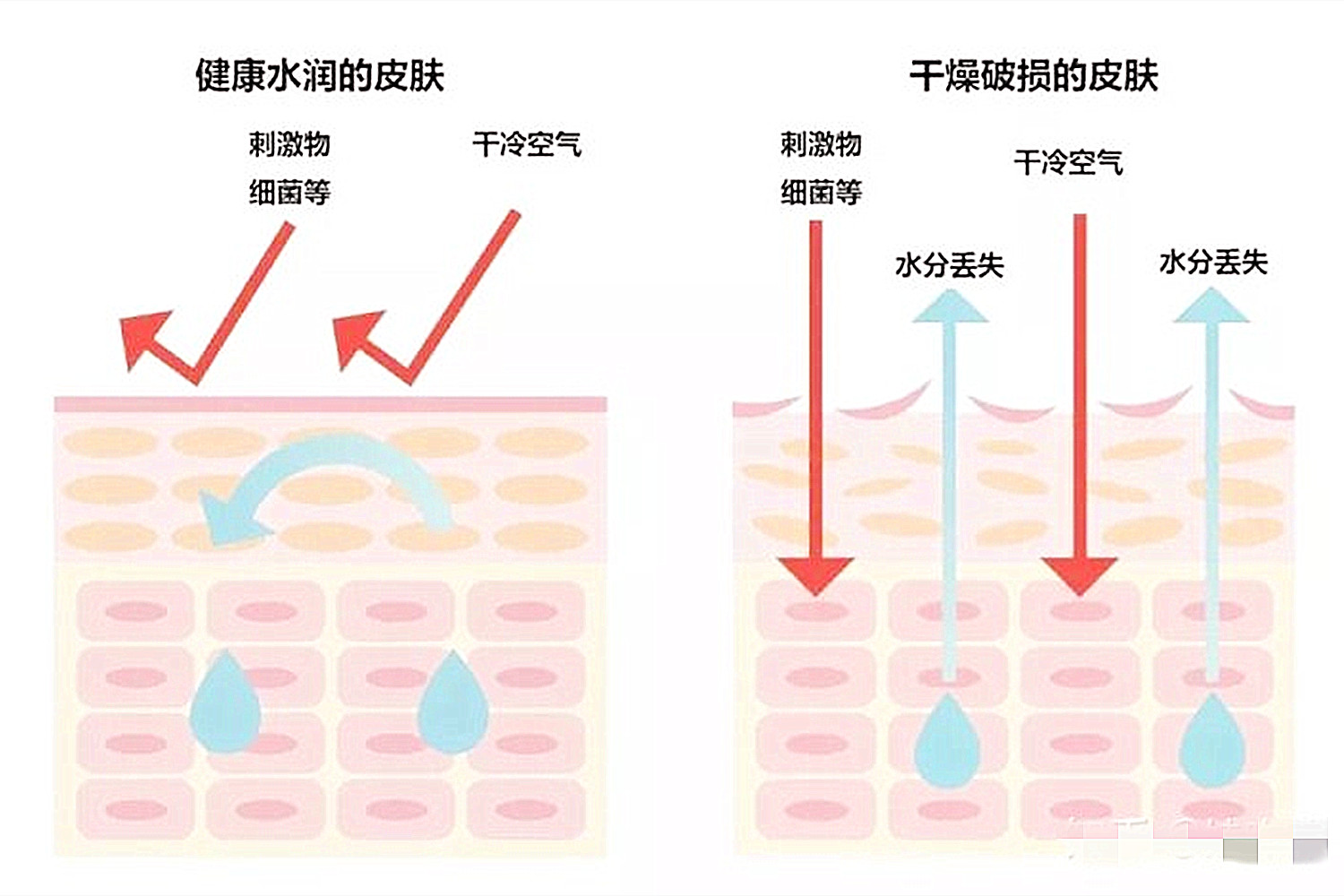 孩子身上有红斑点，痱子还是湿疹分不清，学会这四招教你轻松分辨