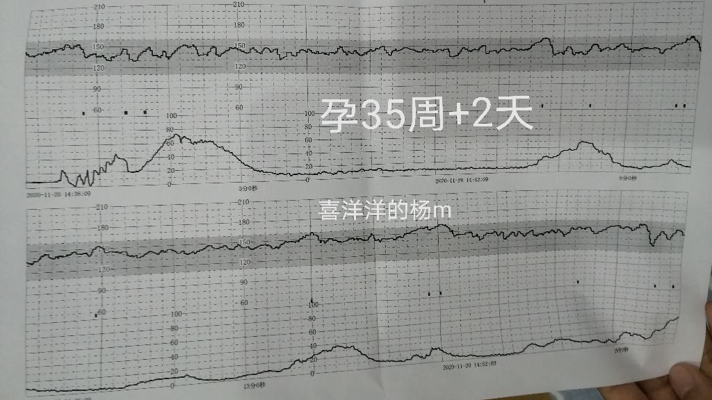 孕35周+2天，第一次到市医院产检和做胎心监护的具体记录分享