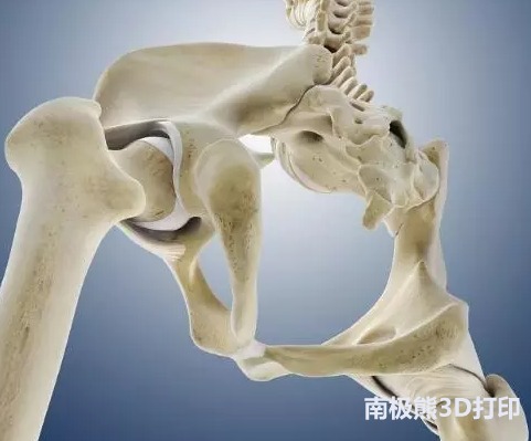 3D打印人工骨行业研究