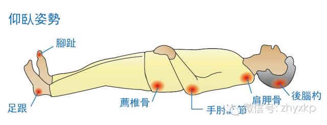 骨隆突部位图片