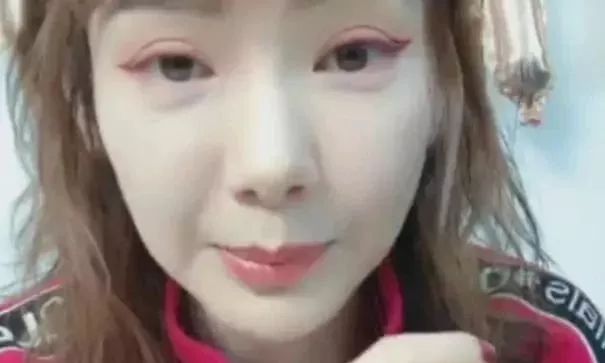 明星明明不差钱，为什么戚薇也会割出肉条双眼皮？