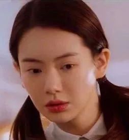 明星明明不差钱，为什么戚薇也会割出肉条双眼皮？