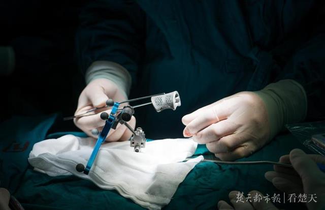 男子腰椎上长了鹅蛋大肿瘤，世界最前沿三大技术为他“撑腰”