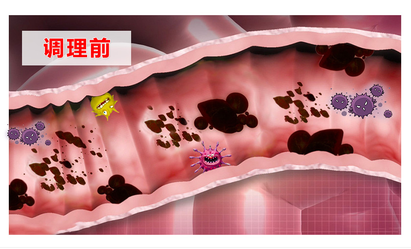 便秘不可怕，清水加上它，肠子便润滑，3天就通便，一次性解决不依赖，不复发！