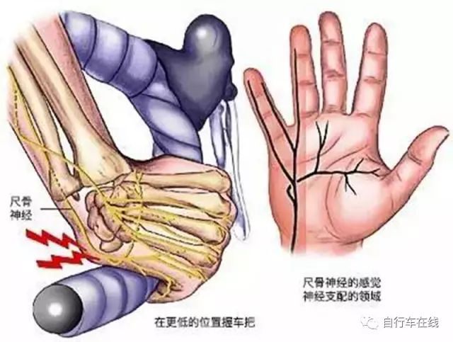 骑行不戴手套危害有多大？看完你就知道了！