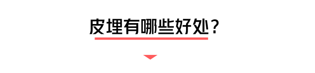 小小一根棒，比套套和上环安全，避孕率超高却少有人知道