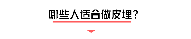 小小一根棒，比套套和上环安全，避孕率超高却少有人知道