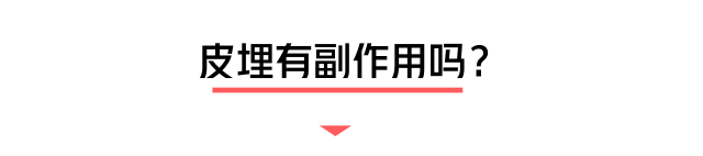 小小一根棒，比套套和上环安全，避孕率超高却少有人知道