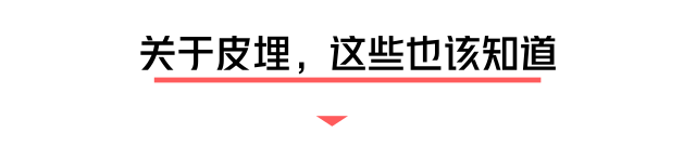 小小一根棒，比套套和上环安全，避孕率超高却少有人知道