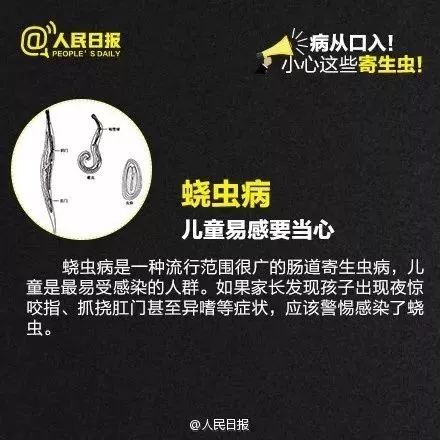 天呐！25岁女子多年头痛，竟因脑袋里有活物在"挖隧道"！