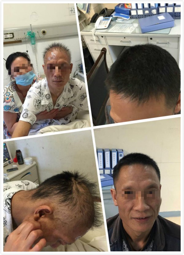 坨中毒(铊中毒最有效的解毒方法)