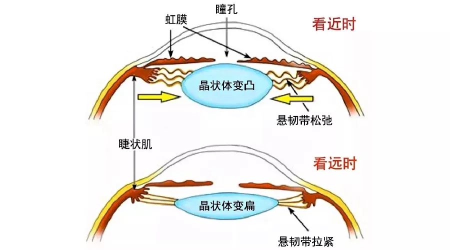 近视了，选择什么样的镜片，度数能发展慢一点