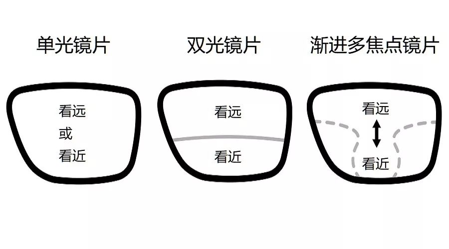 近視了，選擇什么樣的鏡片，度數(shù)能發(fā)展慢一點(diǎn)