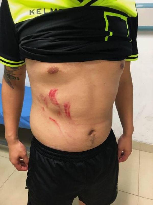 中国足协重罚成超群殴裁判者 涉事俱乐部对“摘牌”持异议