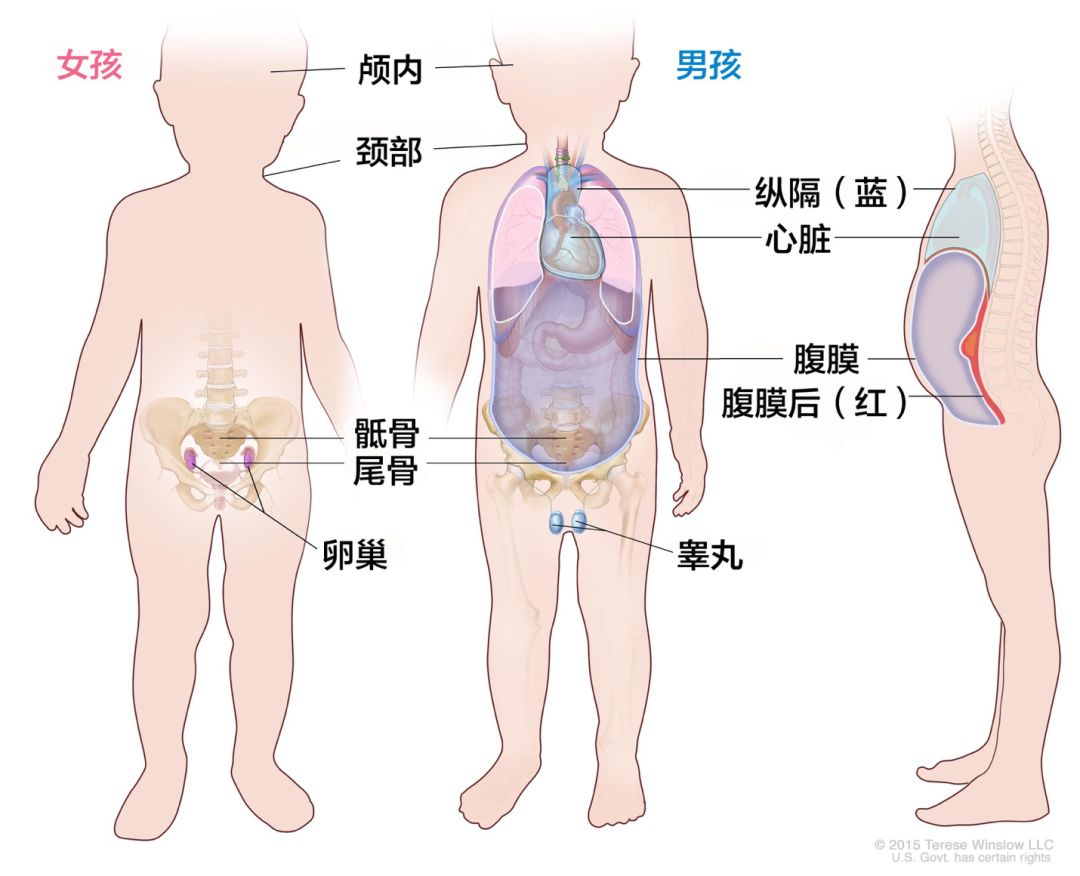 高级别肿瘤出芽(肿瘤会长毛发或牙齿？最常见的生殖细胞瘤如何被发现)