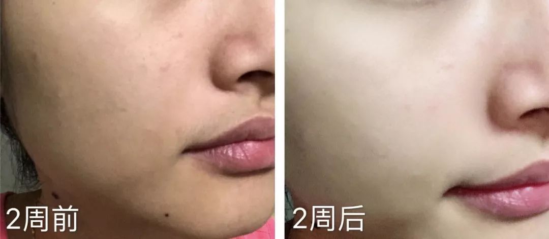 清莹露是干嘛的（清莹露是啥）-大连信息网