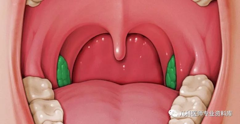 正常的喉咙里面图片图片
