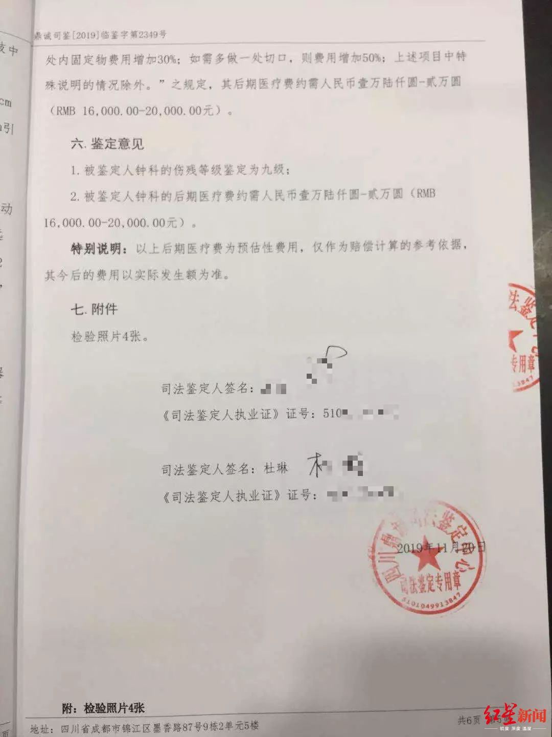 成都男子下班途中被狗撞倒！8根肋骨骨折！更头疼的事还在后面