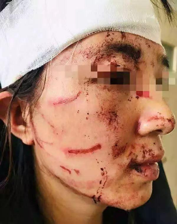 梦见老公和别人打架脸上被沾上上血，解读梦境中的情感与心理