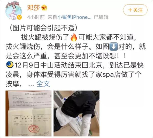 烧伤级别,烧伤级别划分标准