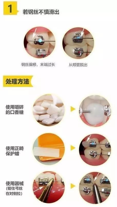 口腔医疗机构停诊！广东多家口腔医院现已开通线上咨询服务