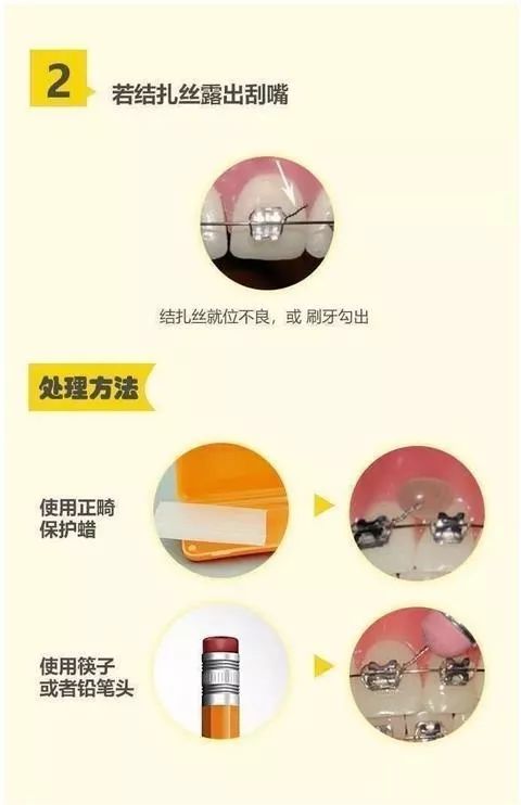 口腔医疗机构停诊！广东多家口腔医院现已开通线上咨询服务