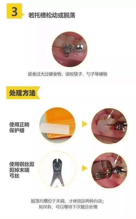 口腔医疗机构停诊！广东多家口腔医院现已开通线上咨询服务