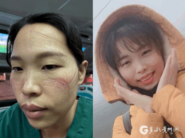 今天，贵州援鄂一个月！这套“贵州打法”，连世界卫生组织专家都点赞了