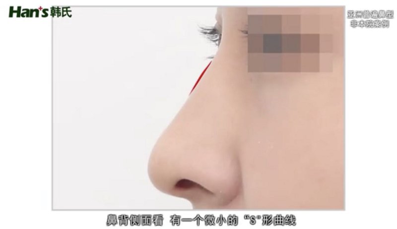 韩啸乃巧鼻专门为亚洲人打造，能够为颜值加分多少？