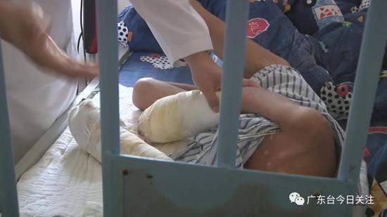 男童遭烫伤面临截肢,男童被火车撞伤截肢