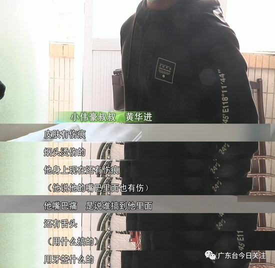 男童遭烫伤面临截肢,男童被火车撞伤截肢
