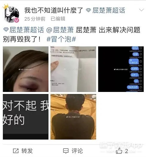 屈楚萧被曝逼女友堕胎，前科累累，再来几次要没戏演了吧？