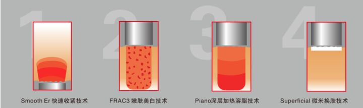 欧洲之星Fotona 4D，全能到打Call的抗衰界新晋神器